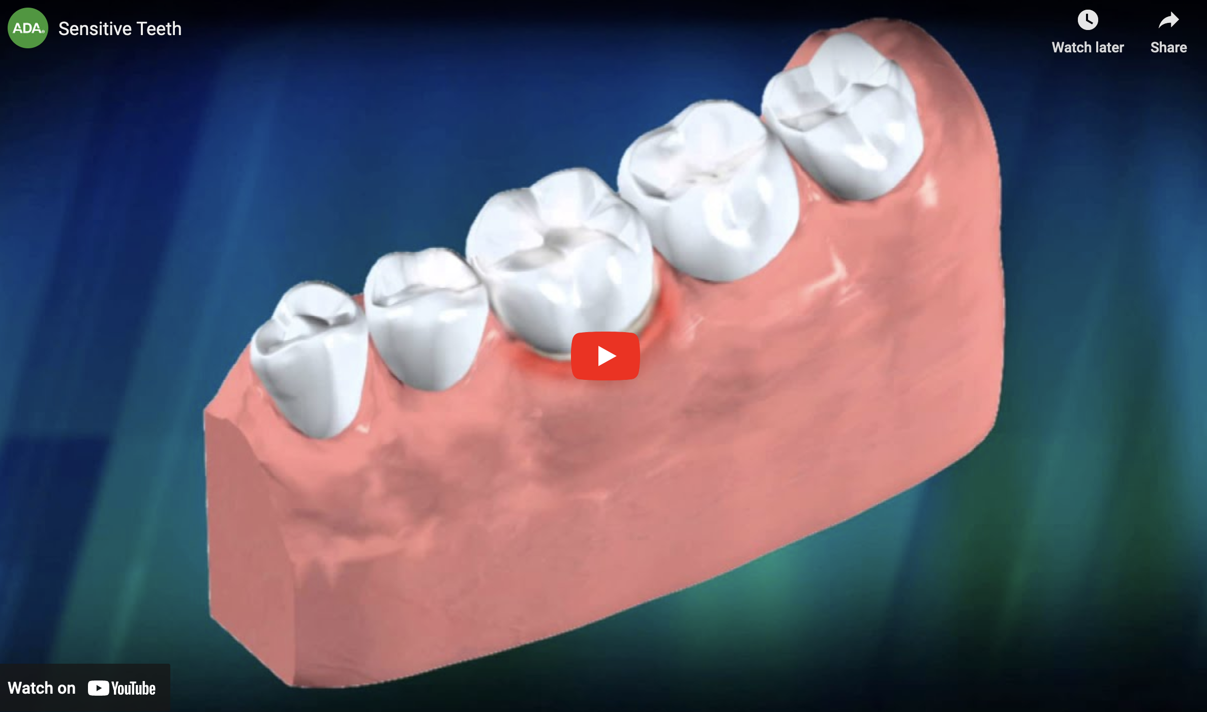 sensitive teeth video